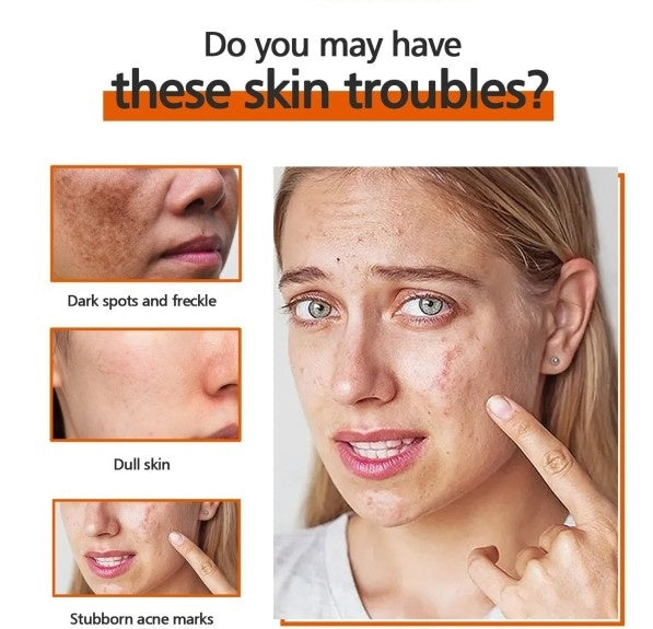Kojic Acid Soap Skin Cleaning Facial Soap 49d5dd32 99db 414a a3a1 29d597dbfe39