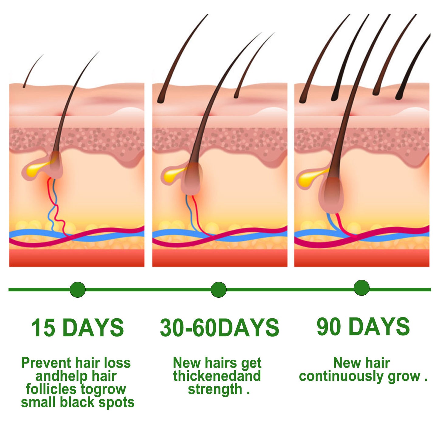 Rosemary Hair Growth 4bab885d b8f1 4986 846d e76c8f7ae88a