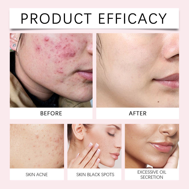 Kojic Acid Turmeric Cleansing Pads Beauty Hot-sale 4c42171f 2c0d 445f 9862 5ed92bdfb30f