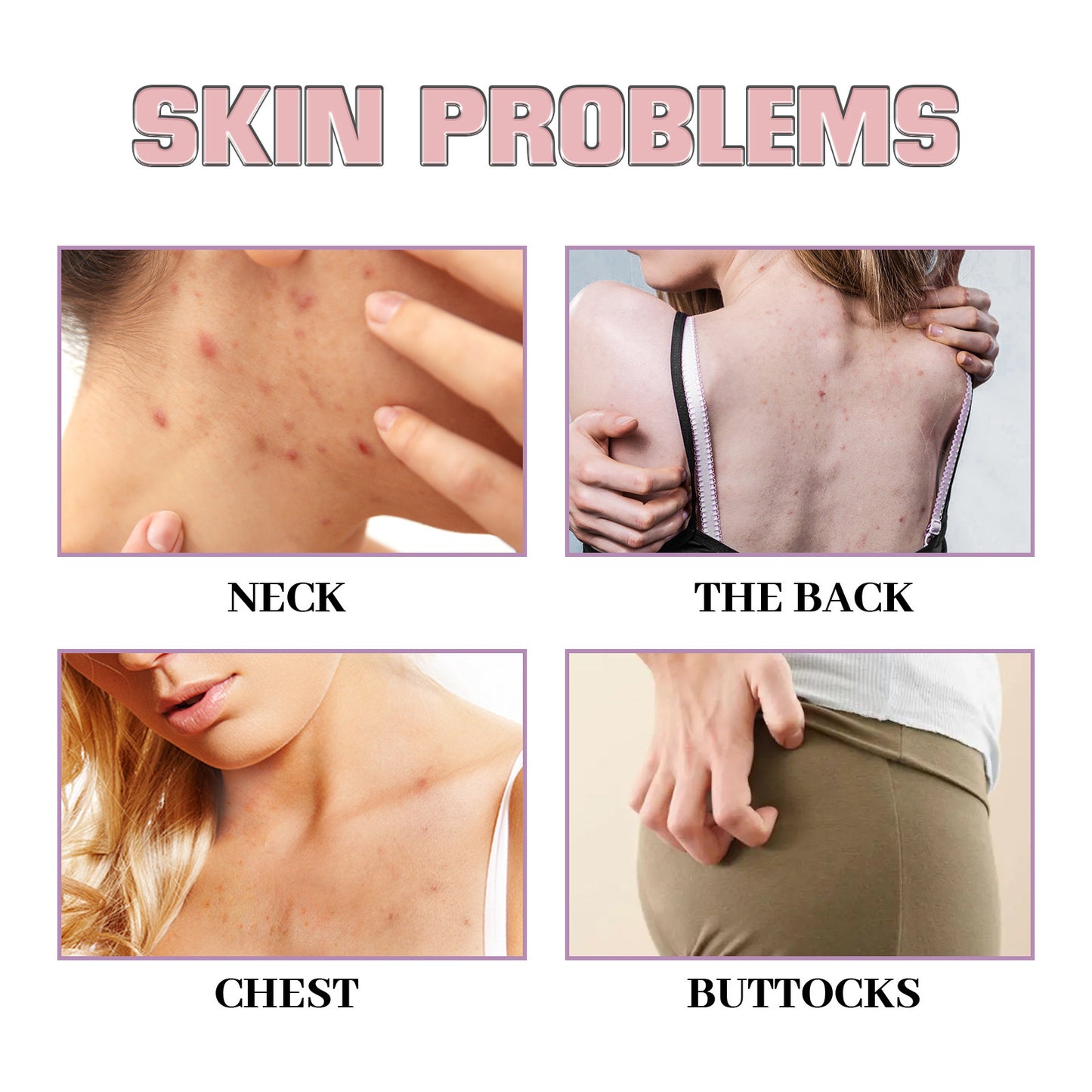 Chest Back Cleansing Fade Acne Print Skin Care Ball 4cb3dd5f f4e5 4e0f bff8 60b75480a2d8