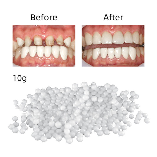 Bagged Household Teeth Repair Solid Hot-soluble Teether Temporary Repair Missing Teeth Gap 511ecf50 0a08 42dd b575 720da4d531