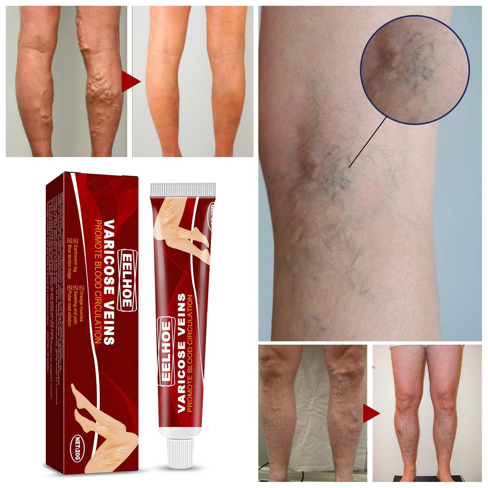 Earthworm Leg Vein Massage Cream For Relieving Leg Vascular Protrusion And Leg Swelling 51b2e213 7929 408e a2a5 bda30c3ce41b