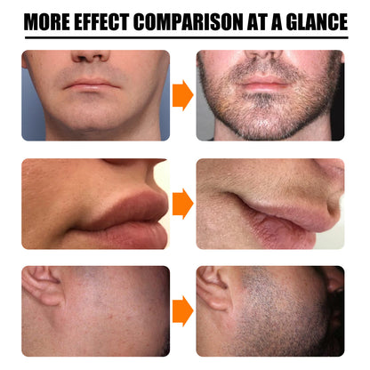 Beard Growth Spray Set Nourishing Moisturizing 56c8b743 9820 45d5 b315 b10341d5fa0b