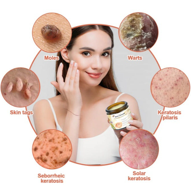 Mole And Wart Body Cream Fade Skin Cleaning 595e5cf7 602d 4649 83b0 5d8b3747759d