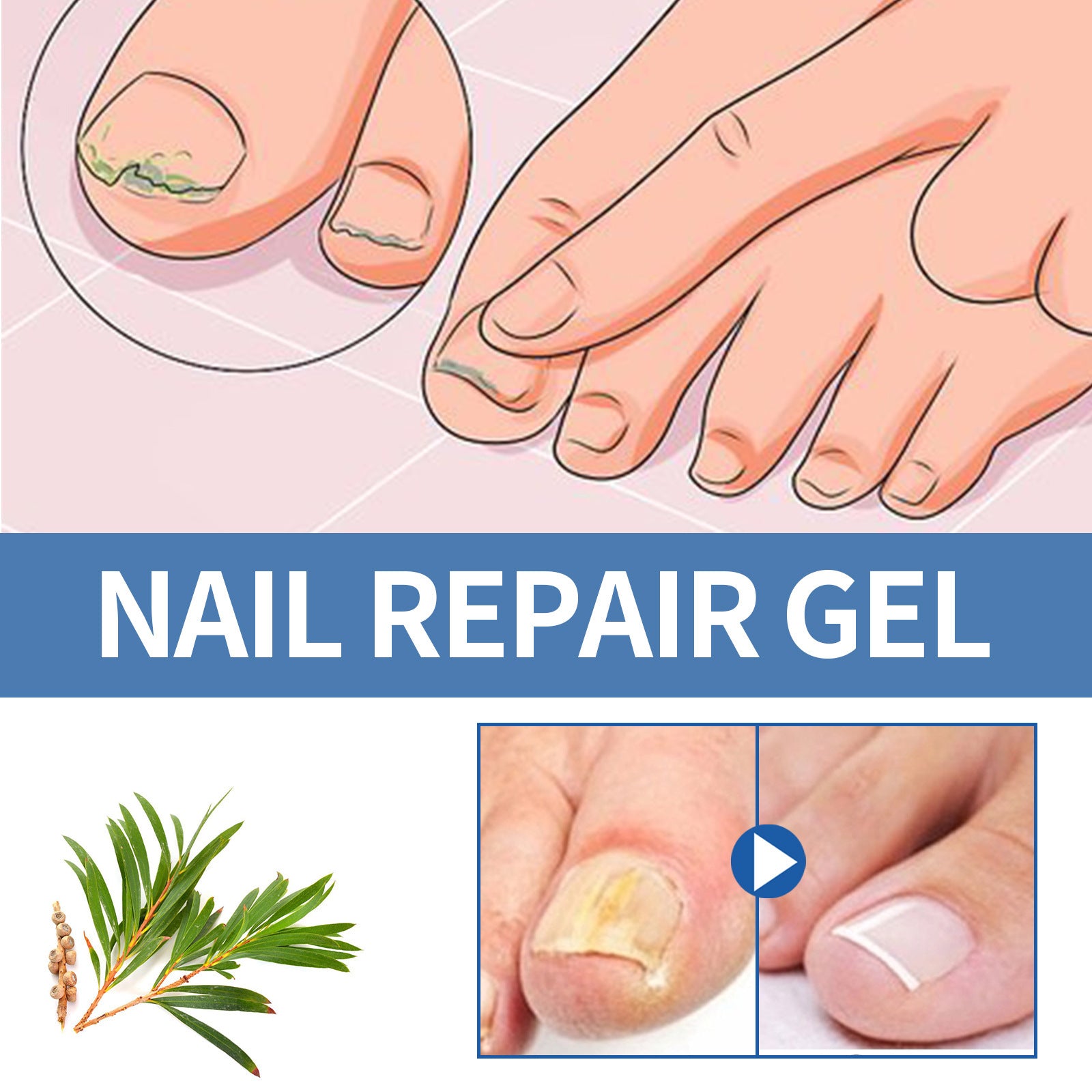 Nail Fungus Care Gel Repair 5ac64e4e c63a 4695 8977 d57696f800cc