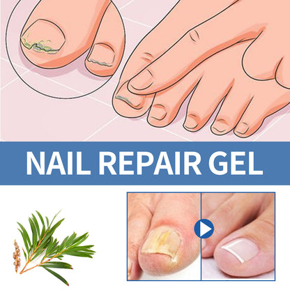Nail Fungus Care Gel Repair 5ac64e4e c63a 4695 8977 d57696f800cc