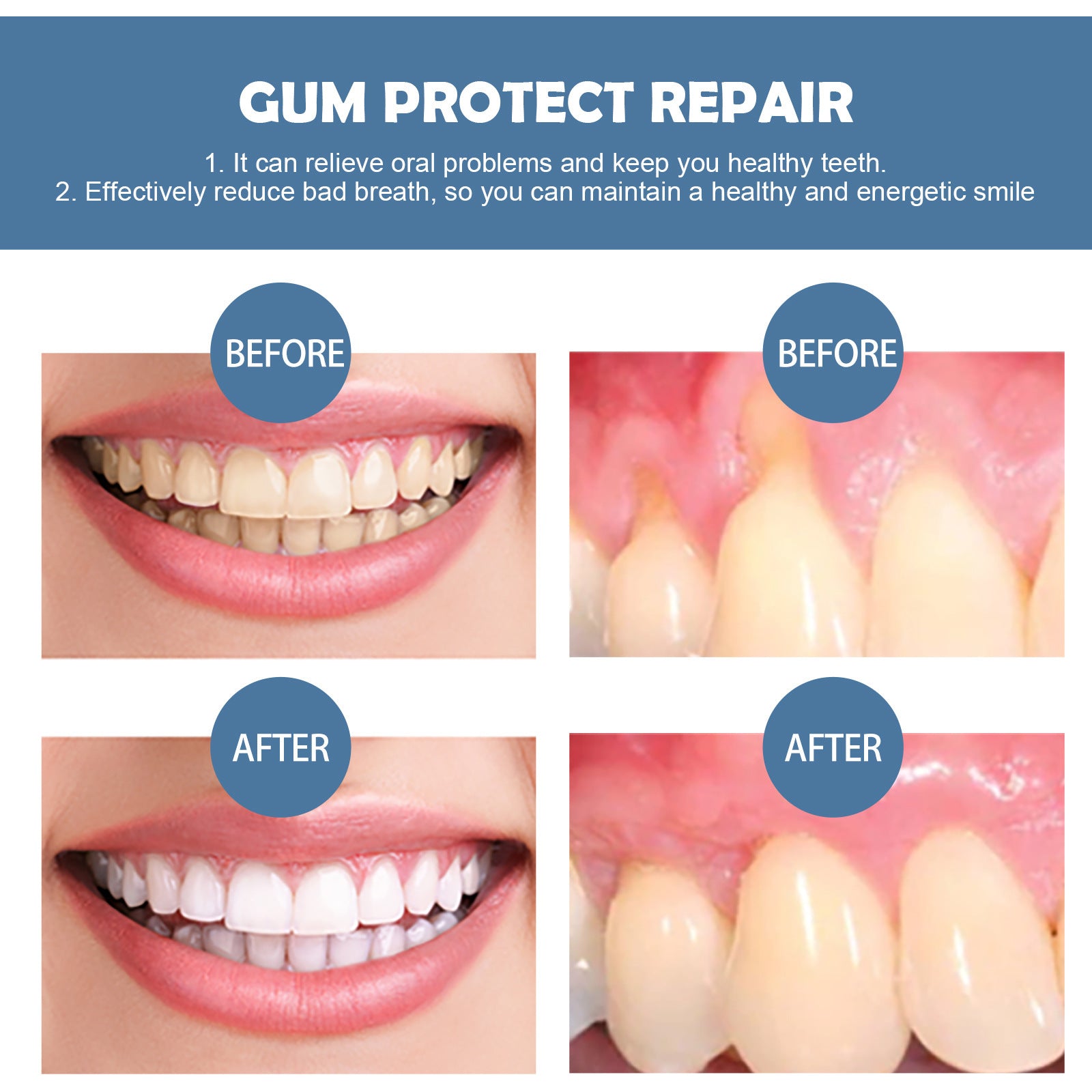 Gum Repair Series Cleaning Tooth Stains 5b95b8b7 d40e 4133 b477 8702281fd9aa