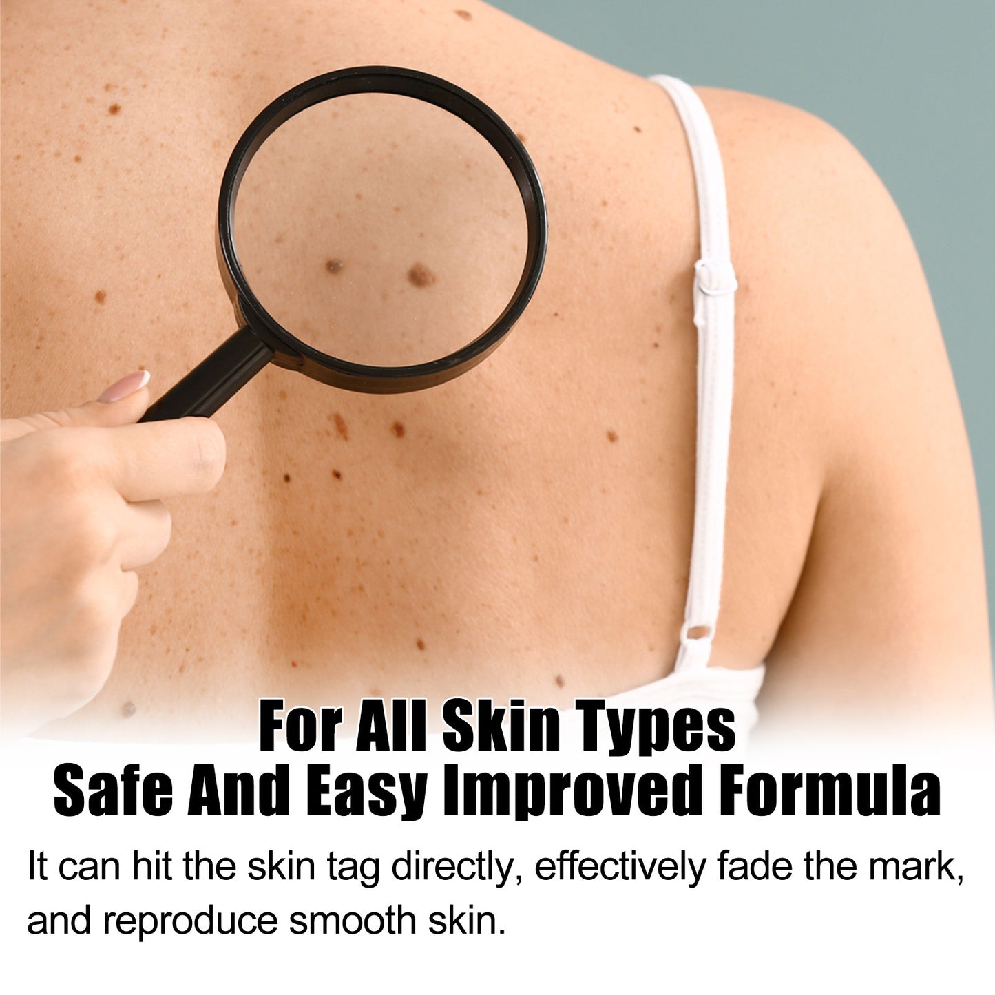 Skin Mole Care Suit Body Cleaning 62dbb3bb c7c8 43e4 b30d 9b9a3fd1d648