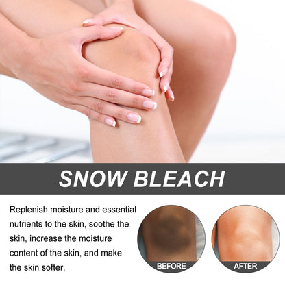 Fade Elbow Knee Joint Black Exfoliating Whitening Skin Beauty 6423b5db 6878 4ce4 a198 c8f7fa05d429