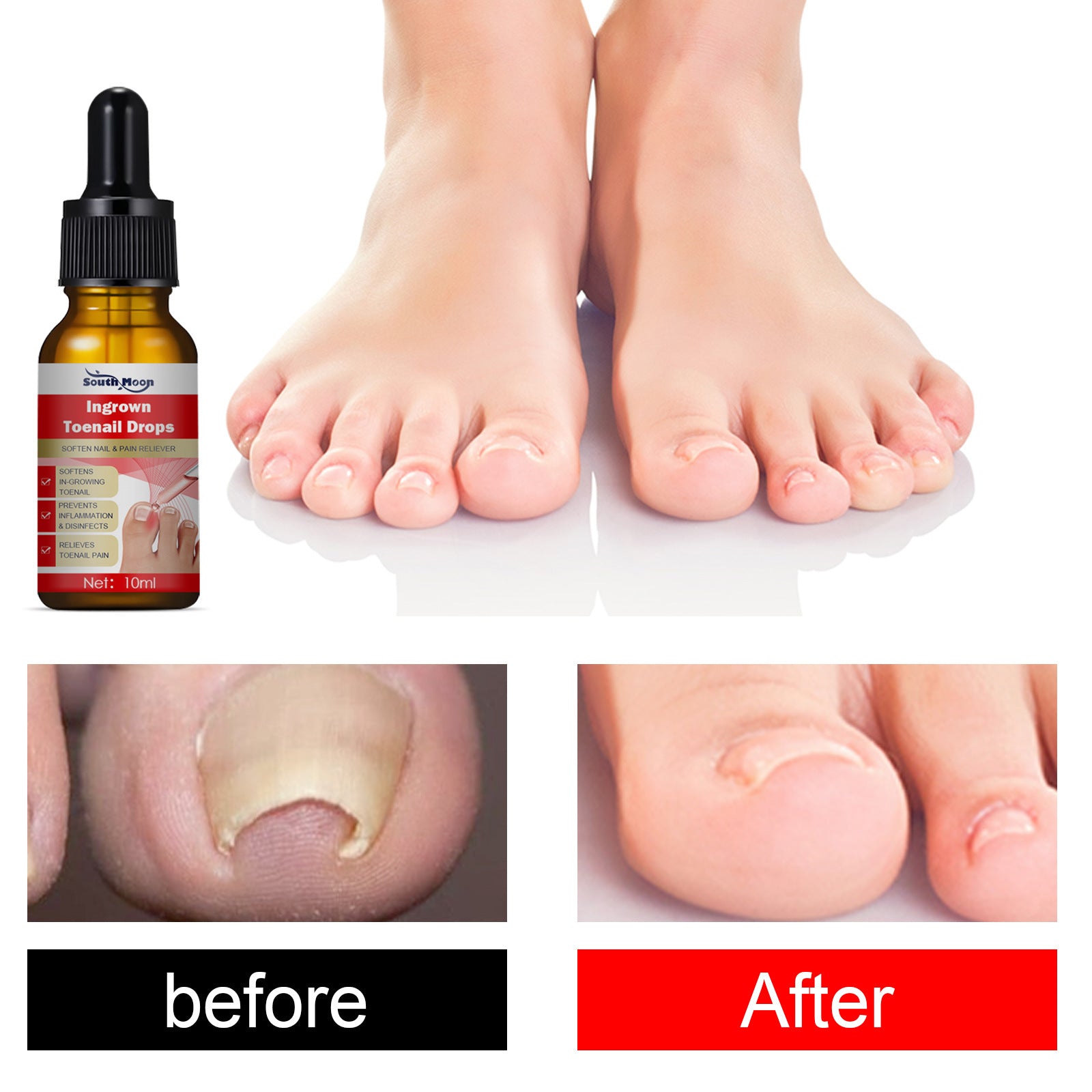 Endogenic Toenail Repair Nail Removal Essential Oil 6541a8dd 689a 44b9 85b9 76b5d73190bb
