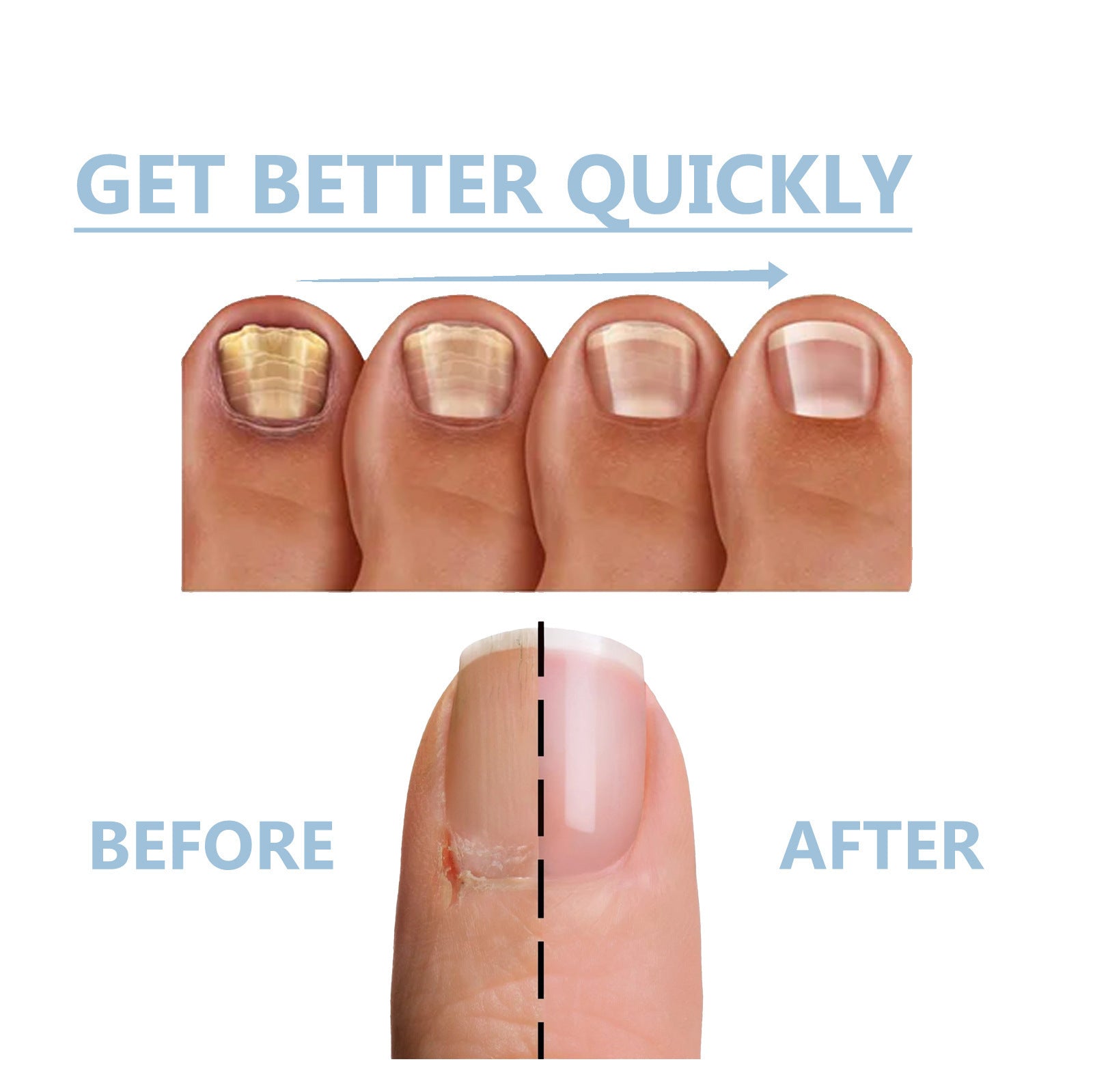 Hand And Foot Nail Nutrition Moisturizing Repair Soft Nail Gentle Cleaning Bright Nail Care 6702dae7 752b 4197 bab1 887e26760