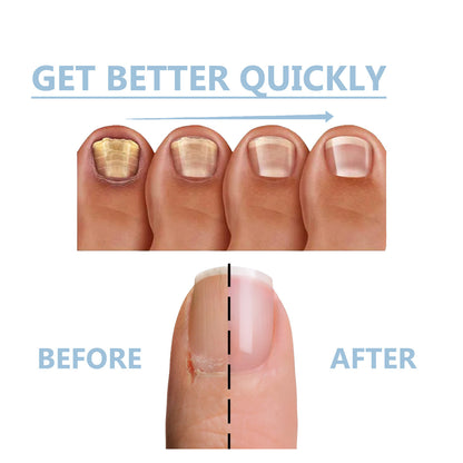 Hand And Foot Nail Nutrition Moisturizing Repair Soft Nail Gentle Cleaning Bright Nail Care 6702dae7 752b 4197 bab1 887e26760