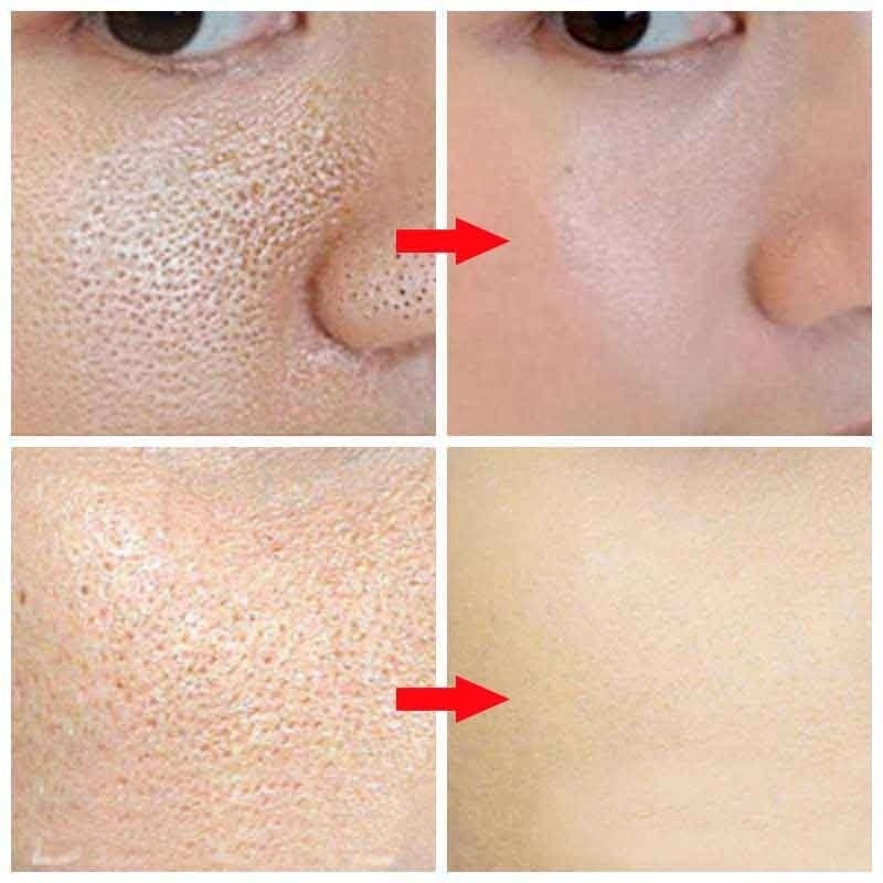 Pore Refining Serum 6ad3fb02 8dc9 4c2c 8155 ea64b35d6728 trans