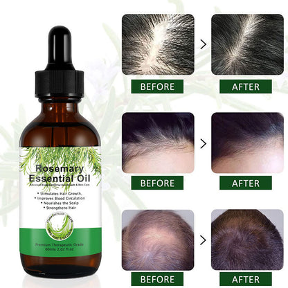 Rosemary Hair Growth 6d2e1987 94d8 4fa9 9994 bba9d0e5146c