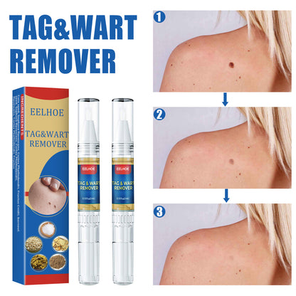 Skin Remove Nevus Pen To Liquid Body Skin Tags 6e20049b a2b7 4dcd a0f4 a598ef6c25a0