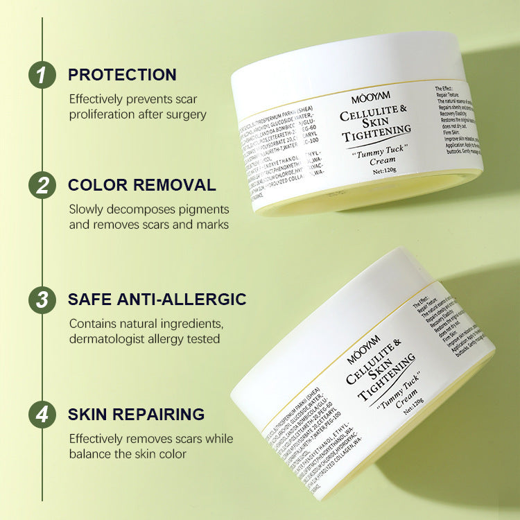 Stretch Mark Cream Fat Body Pattern Recovery Cream 76ca22fa bf3f 4dbb 8098 5844fdaaca72