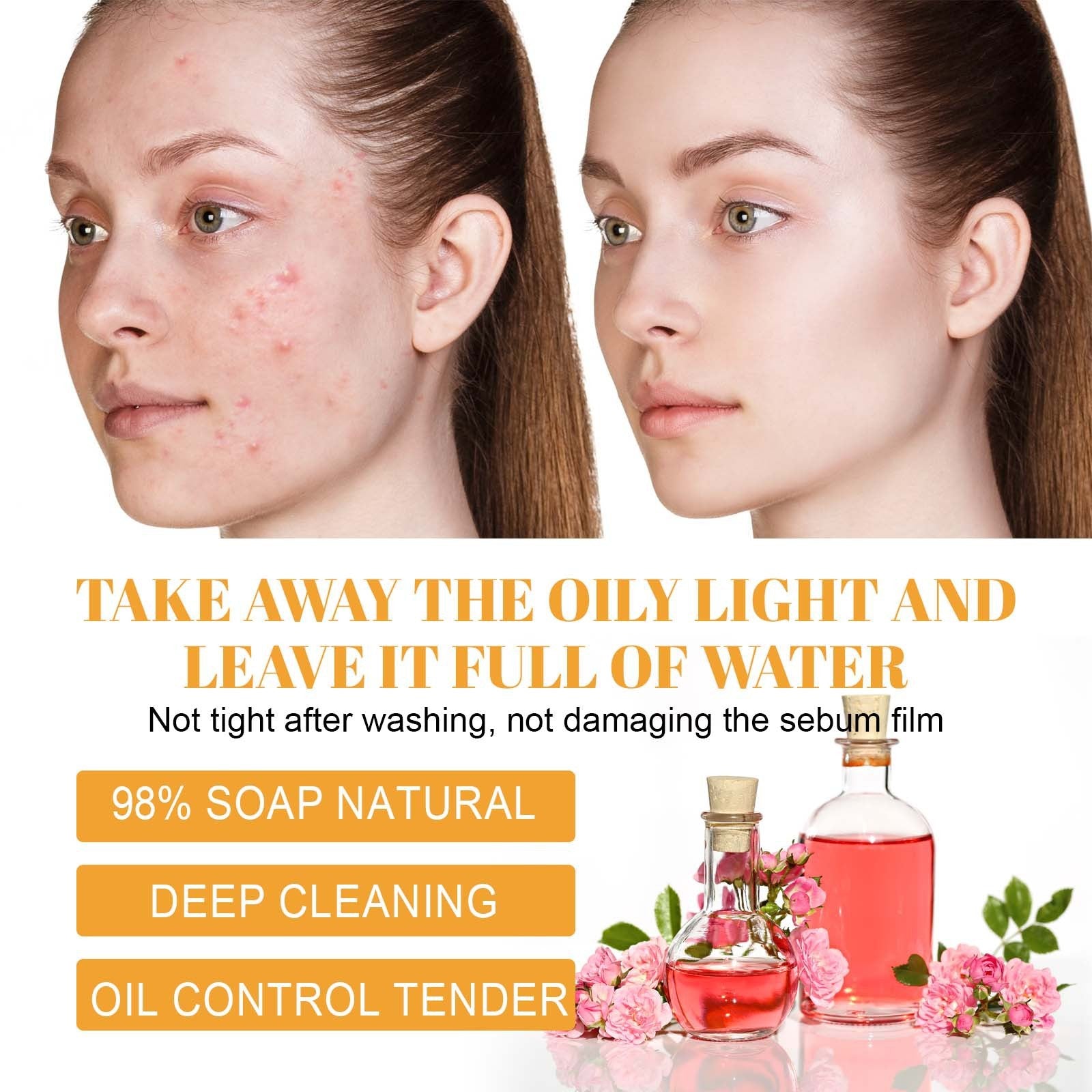 Turmeric Facial Cleanser Deep Cleansing Fade Acne Marks 794e113f 75fd 4151 a60f f9206613aeec
