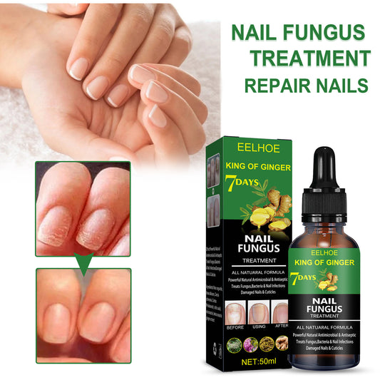 Nail Repair Solution Hand Foot And Nail Care Solution 7a73ce86 4c59 40e1 8e63 ca8f5e305790
