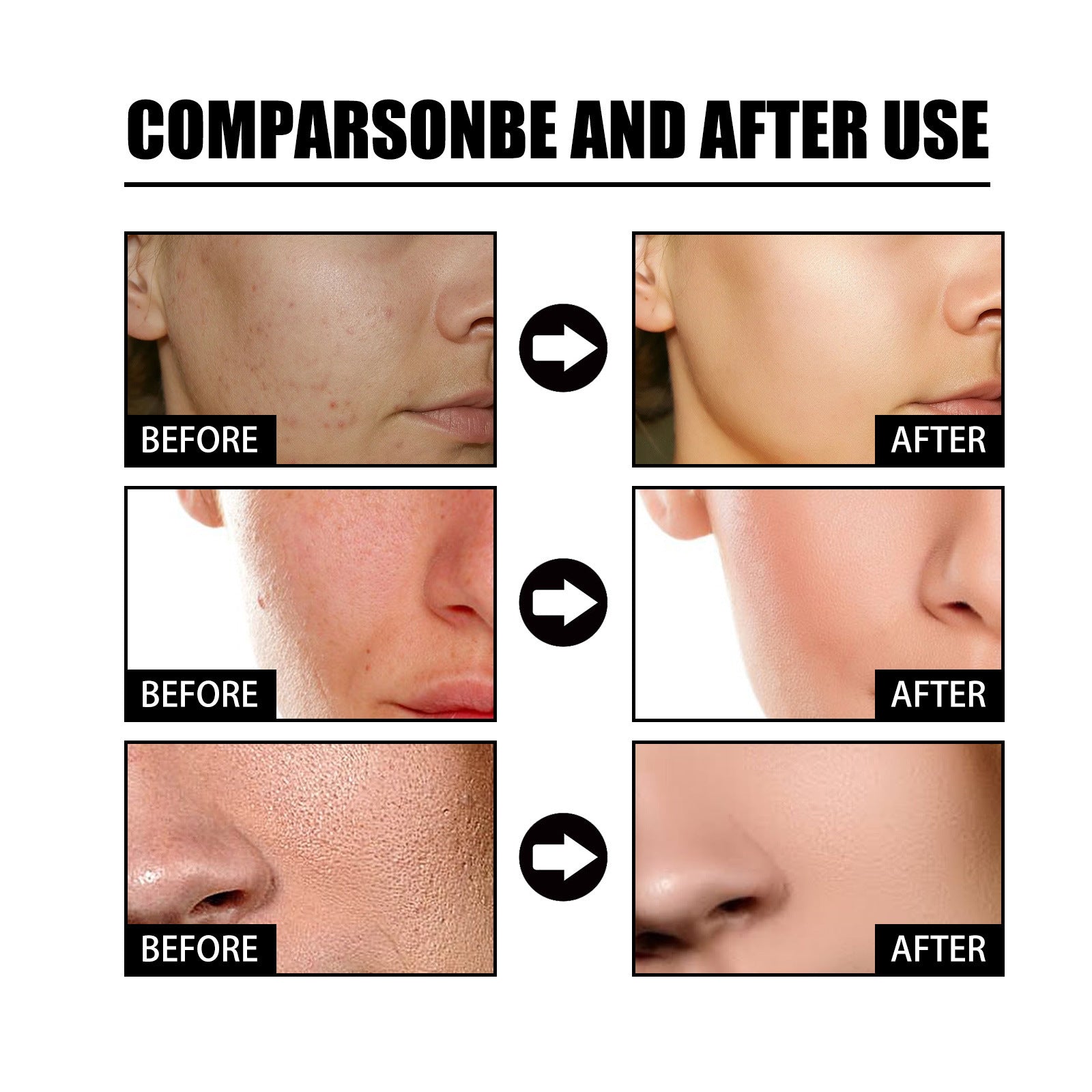 Niacin Facial Pore Shrink Smallpox Diluting Hydrating Moisturizing Whitening Skin Beauty 7b7cc5ac 0df1 4242 aafe e183a6dbfd4e