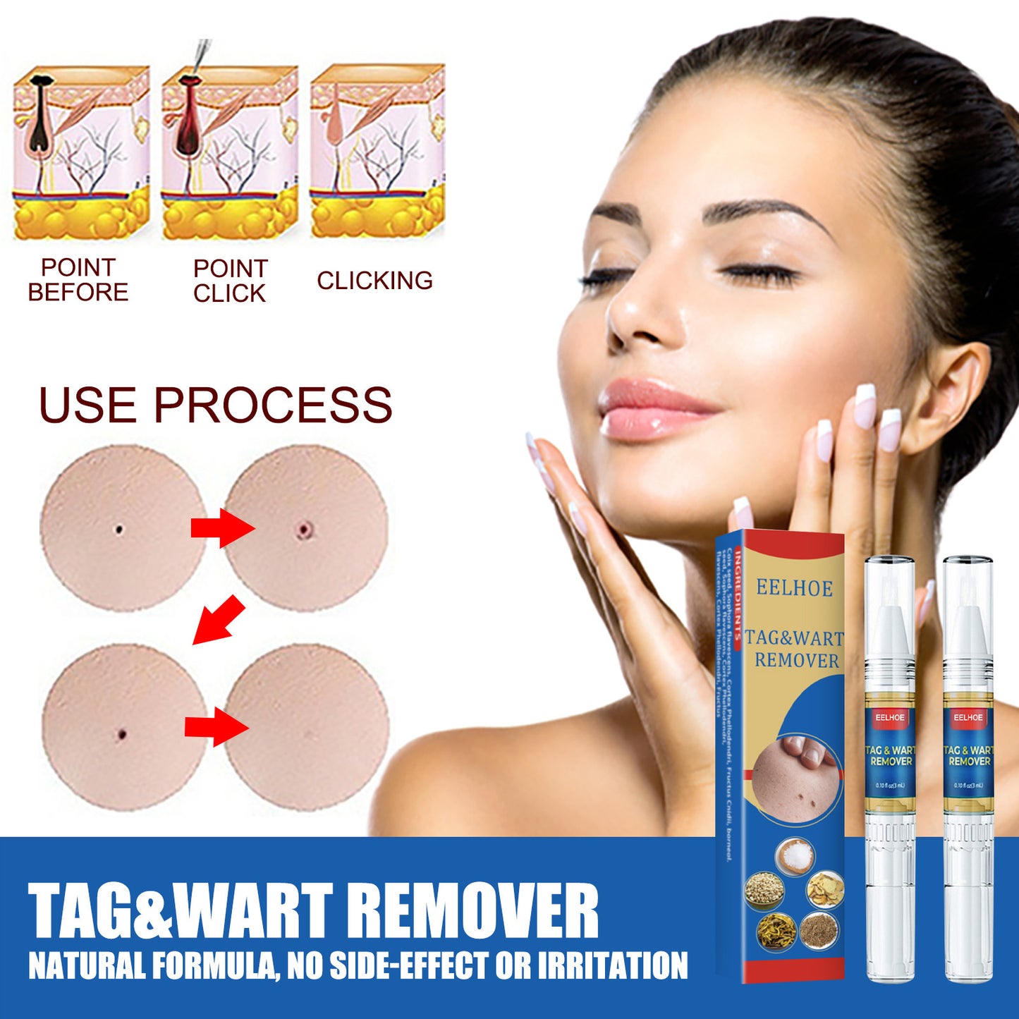 Skin Remove Nevus Pen To Liquid Body Skin Tags 7f27ab14 0ebd 4130 851c 18e85f1ecf03