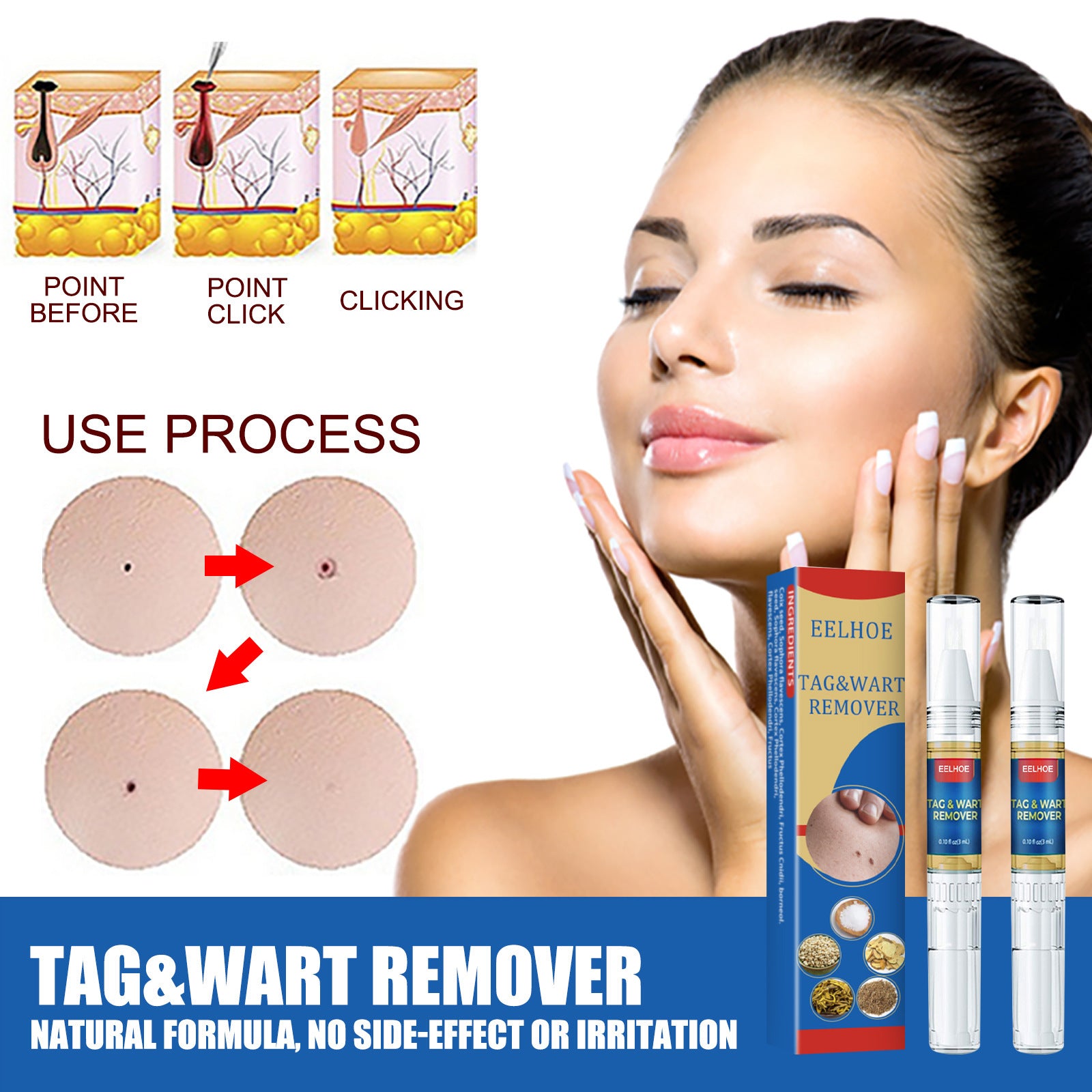 Skin Remove Nevus Pen To Liquid Body Skin Tags 7f27ab14 0ebd 4130 851c 18e85f1ecf03