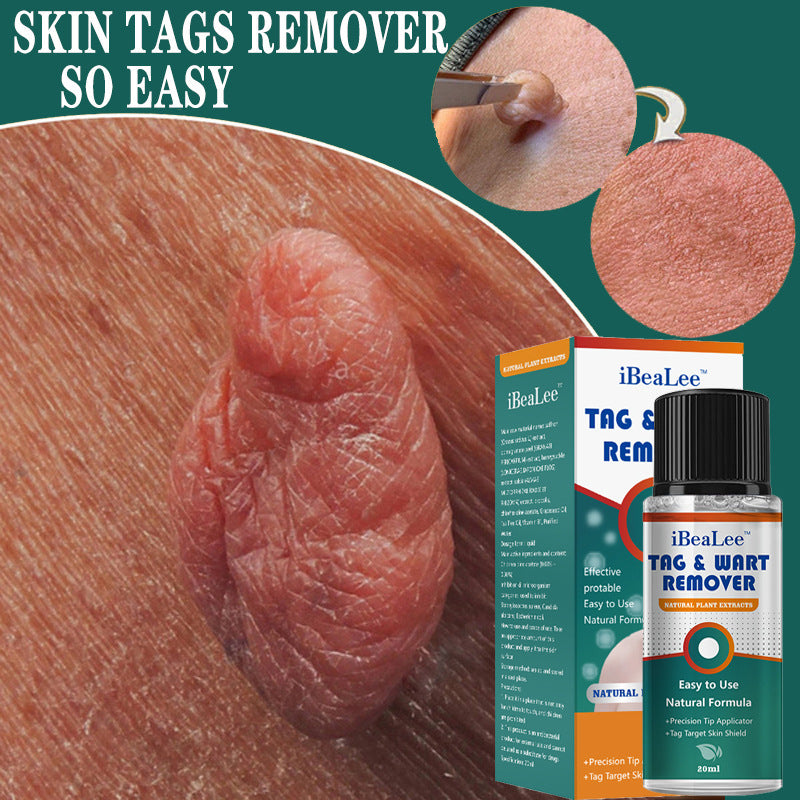 Moisturizing Facial Wart Remover 841097de b3f4 42d4 a4ba 33c1de6ab24c