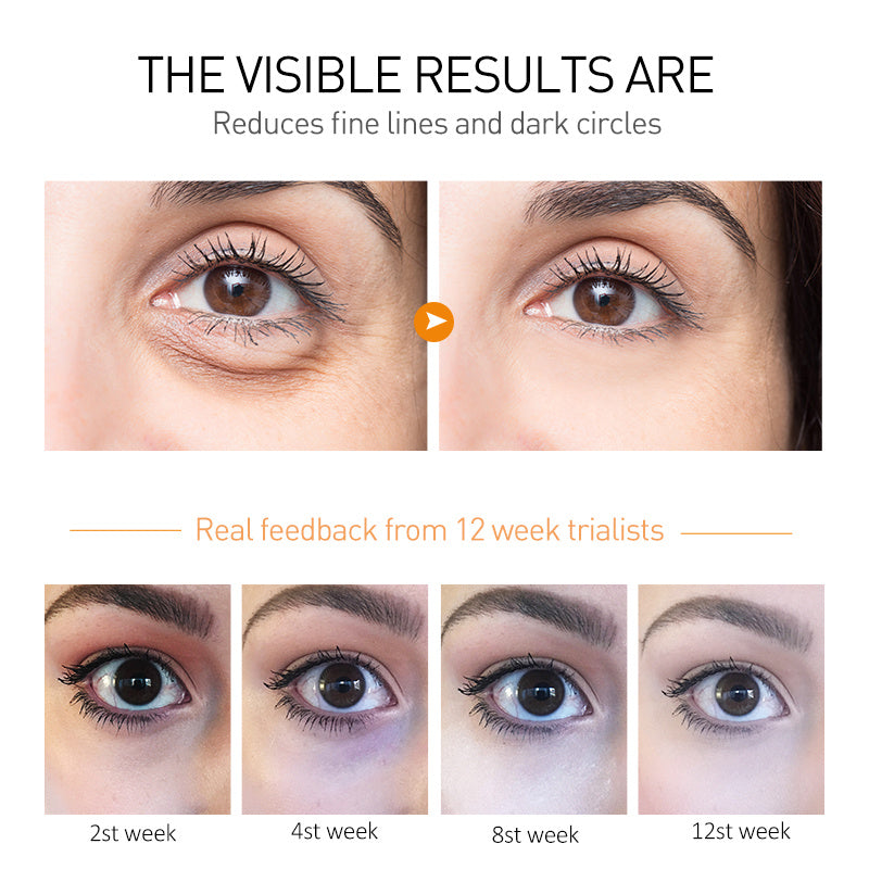 Moisturizing And Firming Eye Cream To Weaken Fine Lines And Dark Circles 841986af 7d6b 4138 9f0a 668845105ab5