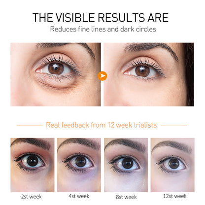 Moisturizing And Firming Eye Cream To Weaken Fine Lines And Dark Circles 841986af 7d6b 4138 9f0a 668845105ab5