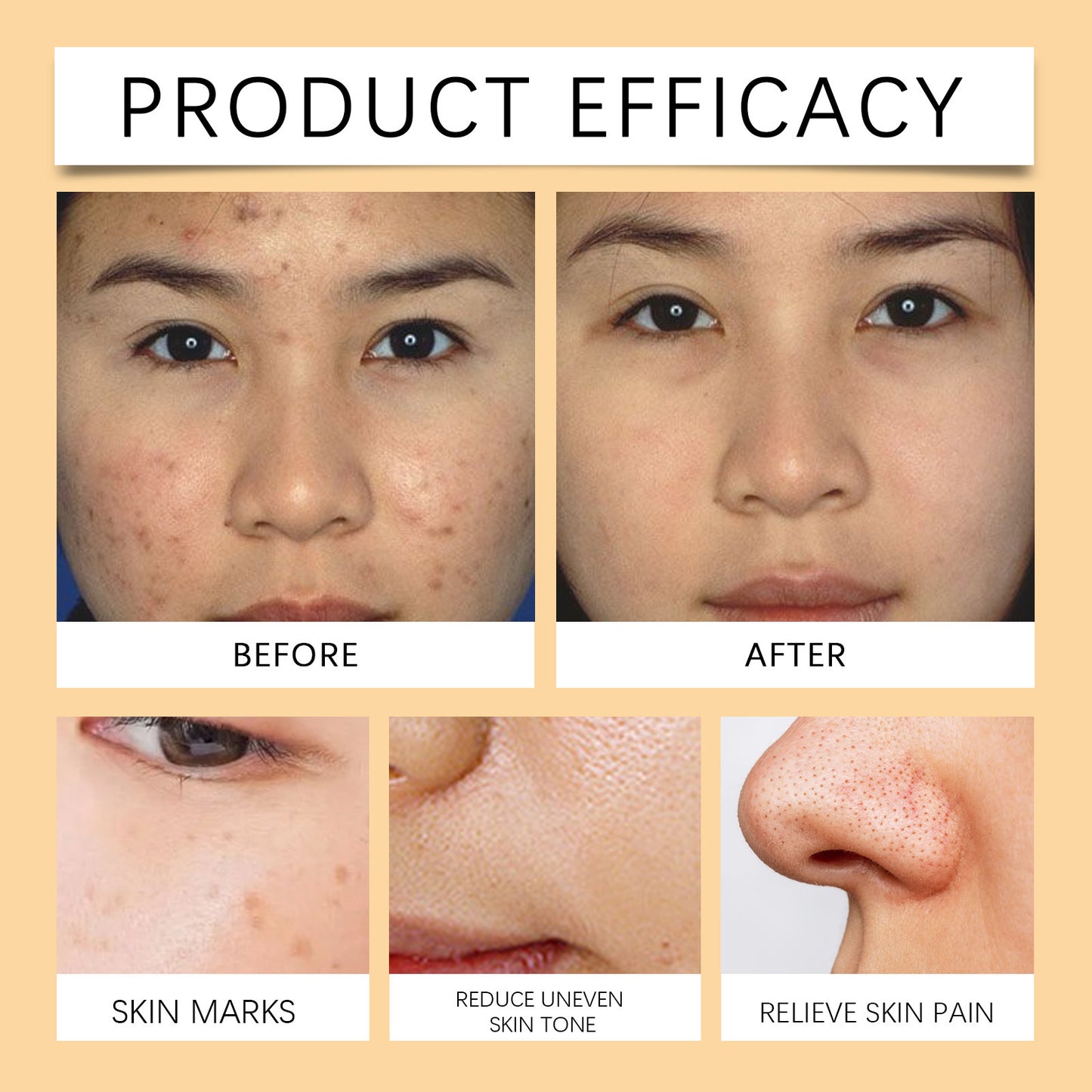 Bee Venom Repair Cream Moisturizing Nourishing And Improving Elasticity