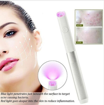 Household Safety Red Blue Light Smallpox Diluting Acne Beauty Instrument 8b381313 64b8 4c5d a019 969bd9d43996