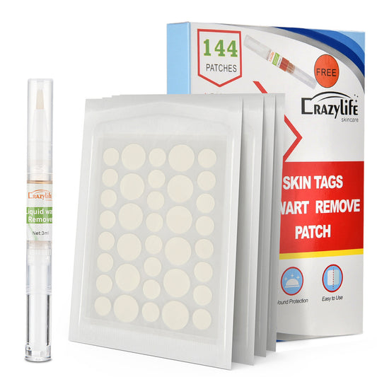 Callus Paste To Remove Warts And Plantar Warts, Foot Calluses And Feet 8eb1e0eb dd40 41b1 863c 1a3cb7e758bb