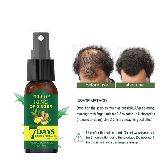 EELHOE Foreign Trade Cross-border Ginger Nutrition Spray Ginger Hair Root Spray Moisturizing Hair Hair Care Spray Spray 8fe66