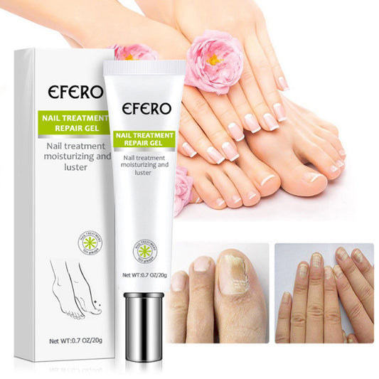 Nail Treatment Serum Nail Foot Nail Fungus Removal Gel Anti Infection Onychomycosis Nail Repair Cream Feet Care 92171a4b e87b