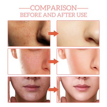Moisturizing Skin Anti-wrinkle Firming Fade Spots 5-in-1 Facial 93ddece3 c59c 42d4 905c a7cdd9e81400