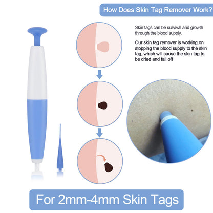 Skin Tag Removal Kit Home Use Mole Wart Remover Micro Band Skin Tag Treatment Tool Easy To Clean Skin Care Tool 96a132d1 4b82
