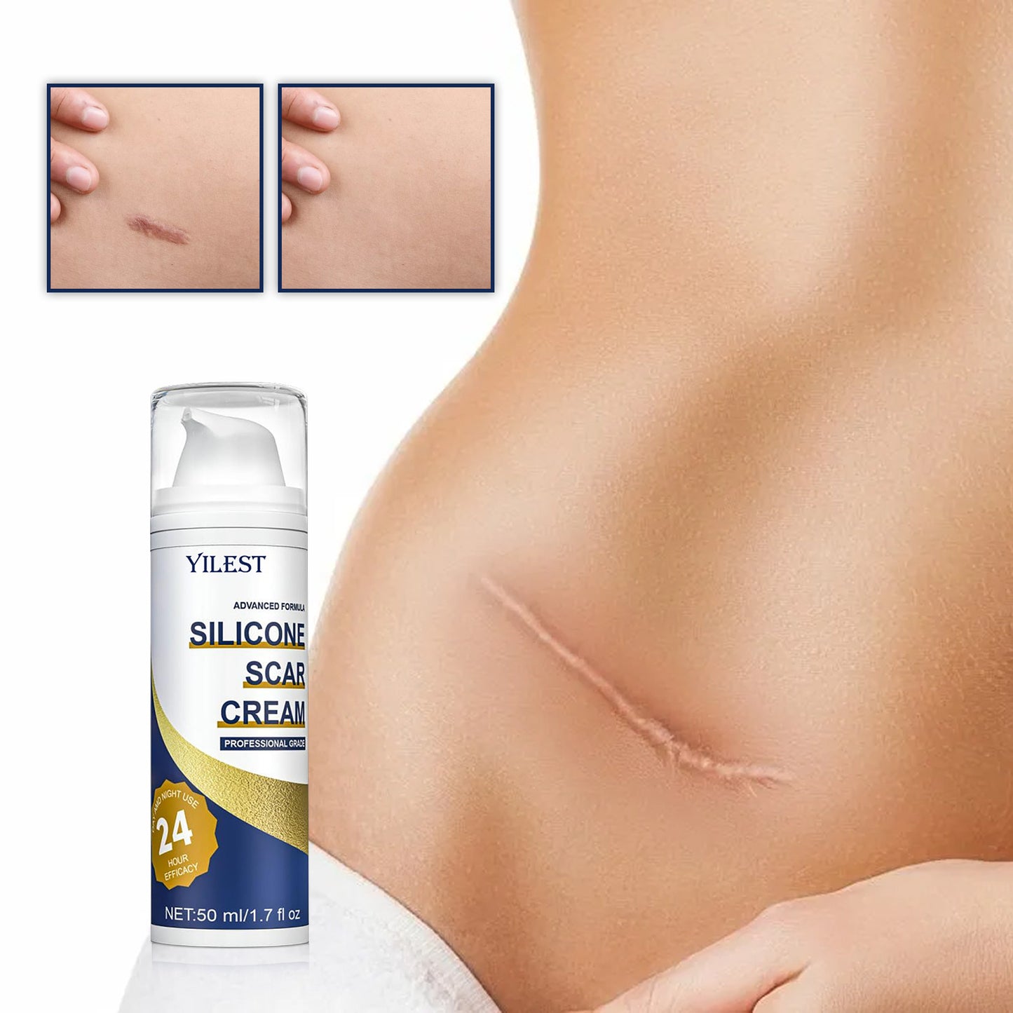 Scar Repairing Of New And Old Trauma Care Cream After Scald And Burn Surgery O1CN017eNueP1YqtB27aTdf  2217637113111 0 cib