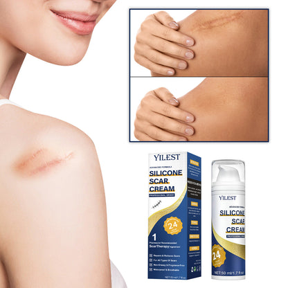 Scar Repairing Of New And Old Trauma Care Cream After Scald And Burn Surgery O1CN01m3aelW1YqtAzKseF4  2217637113111 0 cib