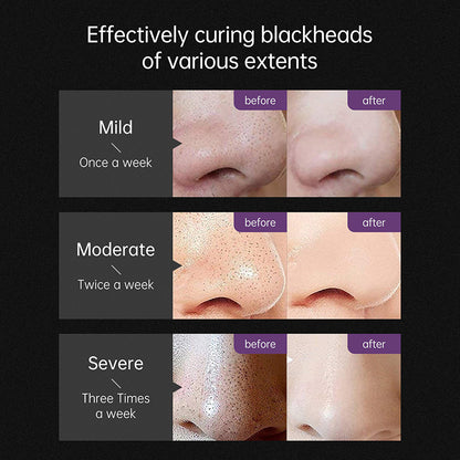 Blackhead Removing Nose Cream T Area Care Clean Shrink Pores Mask O1CN01zbQG0R1Z7NArsdibj  3709483147 0 cib