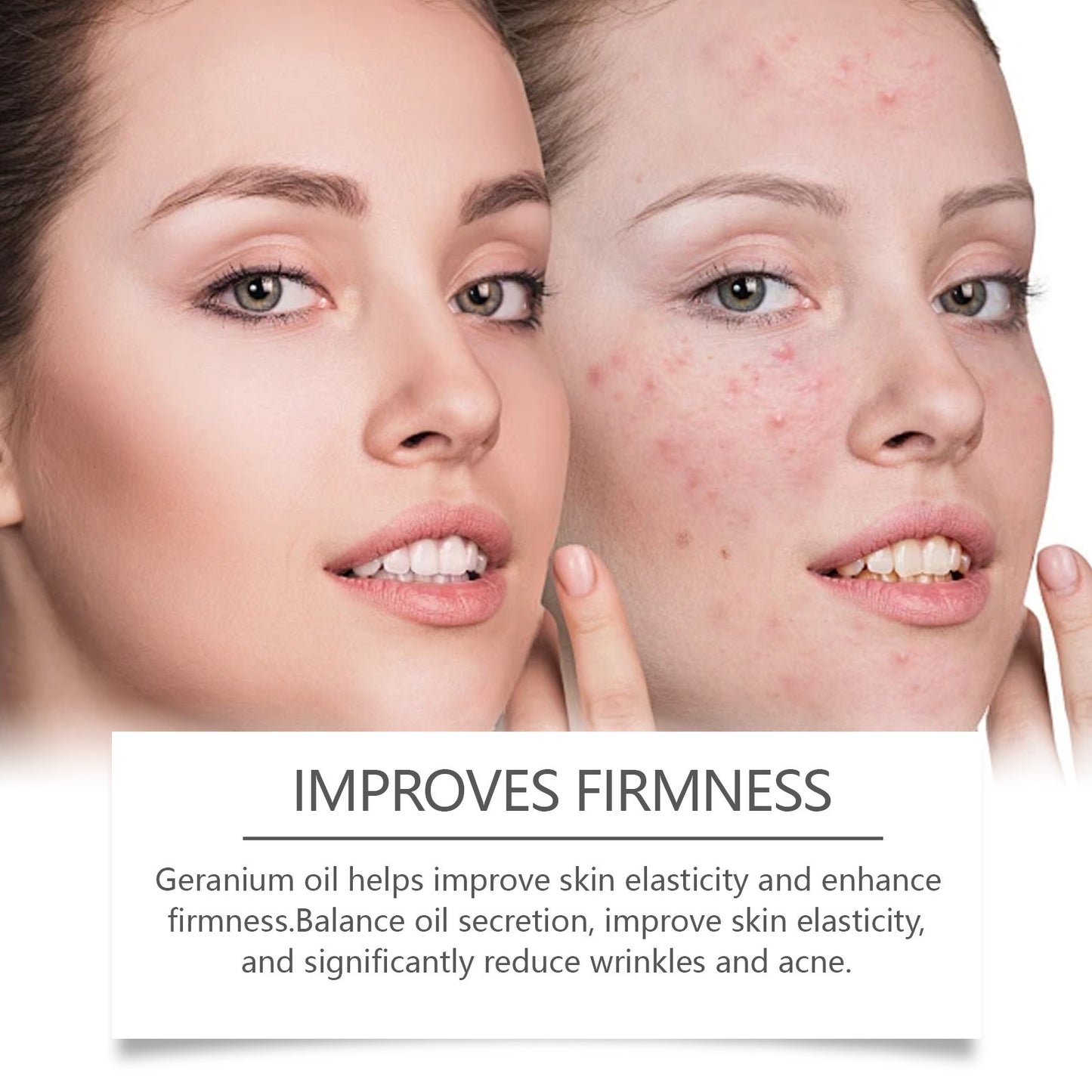 Retinol Oil Repair Facial Acne Skin a54ece5c 38db 4f55 98ce 1086624905e5