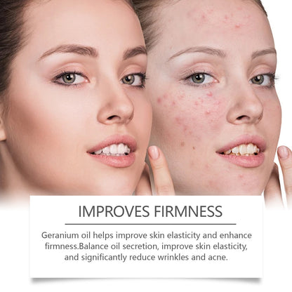 Retinol Oil Repair Facial Acne Skin a54ece5c 38db 4f55 98ce 1086624905e5