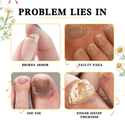 Hand And Foot Gray Nail Soft Yellow Thickening Bright Cleaning Repair a77110e3 b5b4 40bc a03d ce67ac564eb6