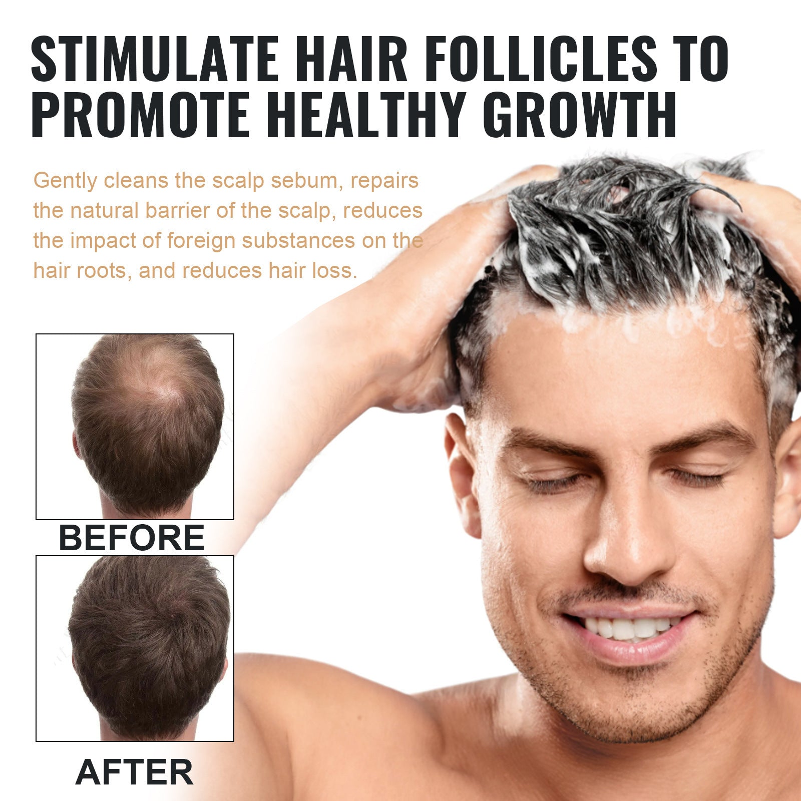 Anti-hair Loss Solid Thick Fluffy Hair Soft Strong Repair Shampoo a85f68cd fd58 4dcb bd01 cf56eadd2871