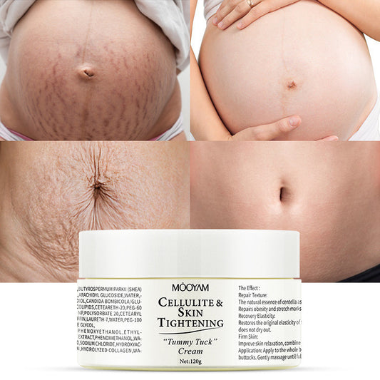 Stretch Mark Cream Fat Body Pattern Recovery Cream a91915ed 5882 4cc6 b507 36f5c368f052