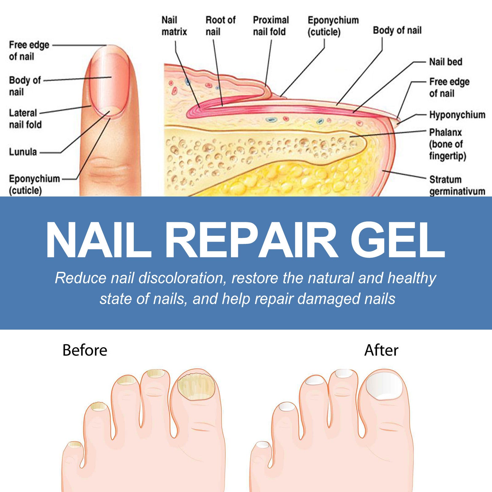 Nail Fungus Care Gel Repair a928ef70 8066 4c3c b89f da59357defb9