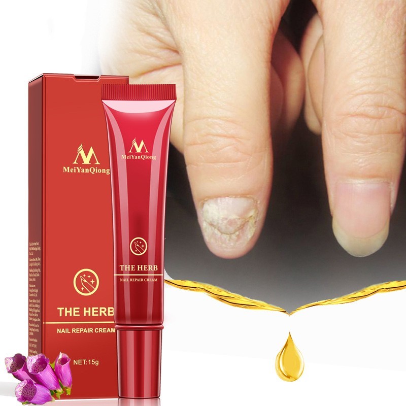 Beauty Hand And Foot Nail Repair Cream ad7dc8d3 a9d3 4679 bee1 2f6723978773