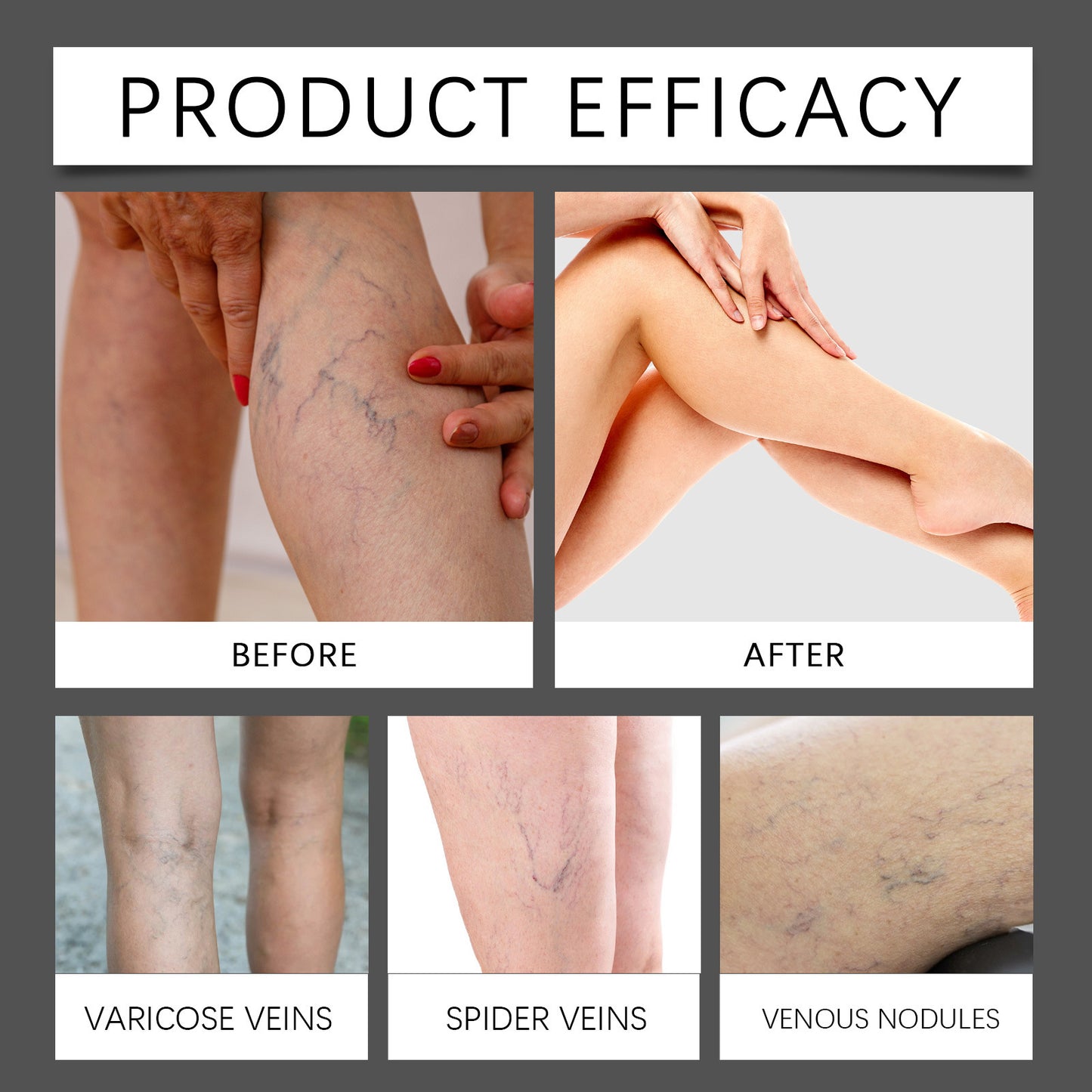 Leg Neck Cream Gentle Relief Discomfort b30275b5 dbc7 4d41 b8d8 b804a57b4904