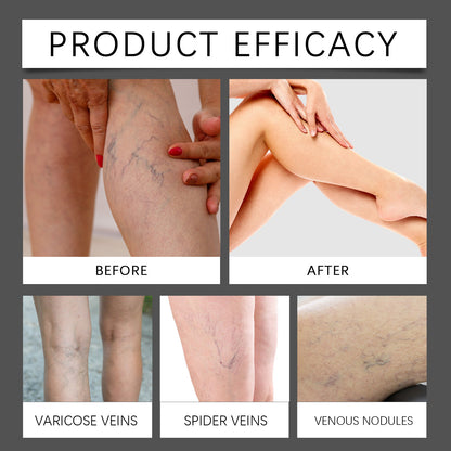 Leg Neck Cream Gentle Relief Discomfort b30275b5 dbc7 4d41 b8d8 b804a57b4904