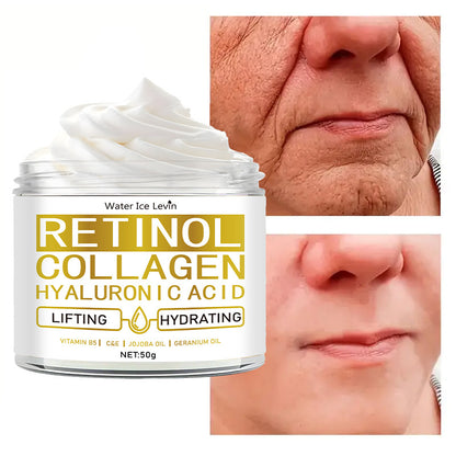 Retinol Cream 50g Deep Hydrating