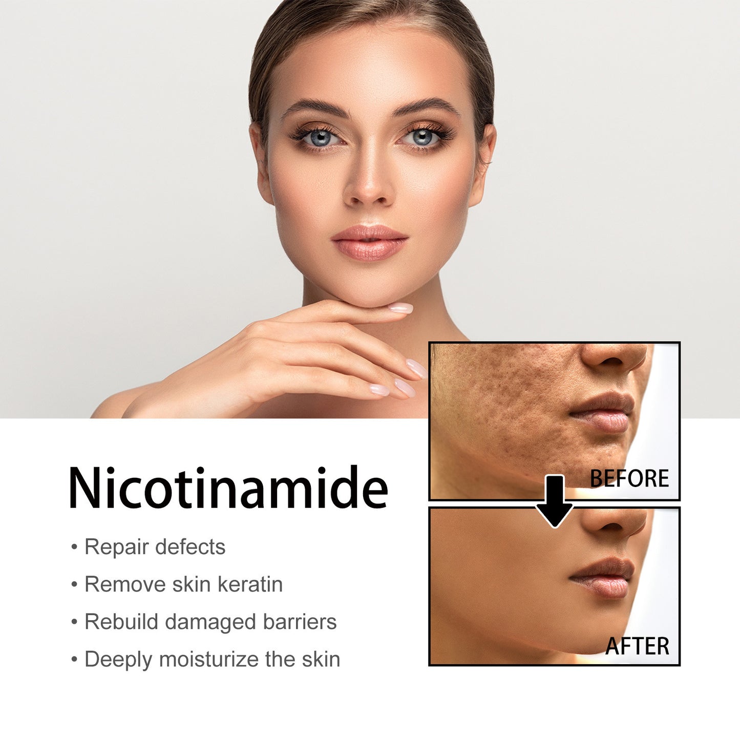 Niacin Facial Pore Shrink Smallpox Diluting Hydrating Moisturizing Whitening Skin Beauty b4c927d3 a80b 42de 87fc bcb095a55cee