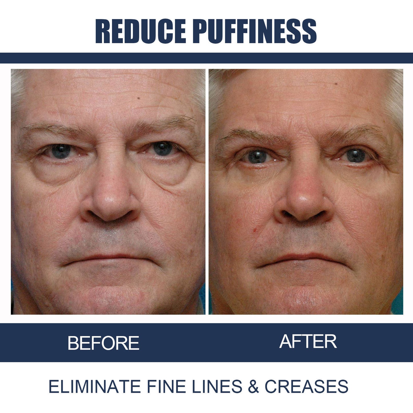 Men's Retinol Firming And Lightening Dark Circles Moisturizing Eye Cream b8c3e694 bf4f 4e2c ab09 bf78c315f910